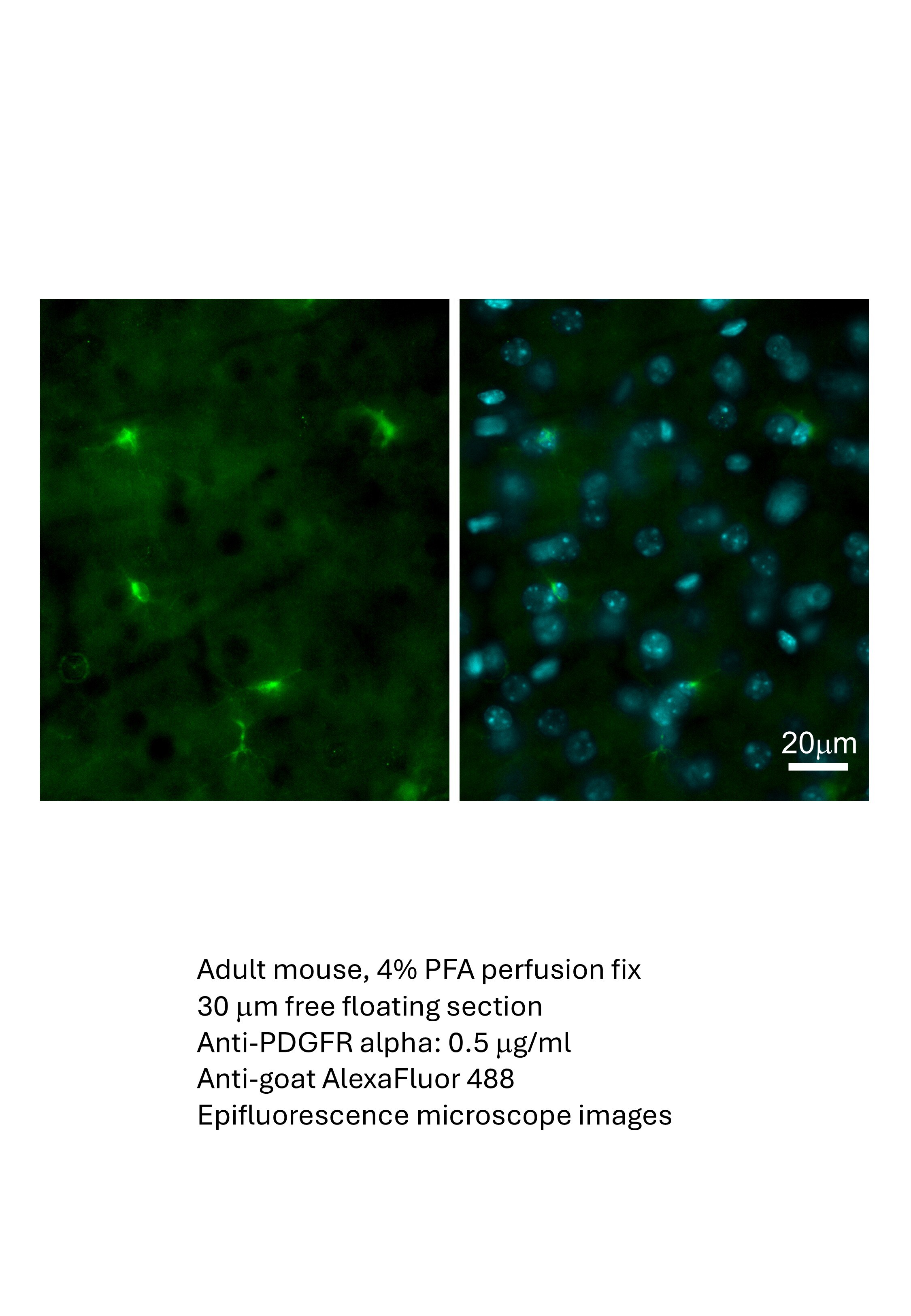 Mouse PDGF R alpha  Antibody AF1062
